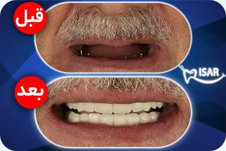 قیمت طلا ظهر امروز ۲۸ مهر ۱۴۰۵/ طلای ۱۸عیار ۳۸۷ هزار تومان گران شد + جدول